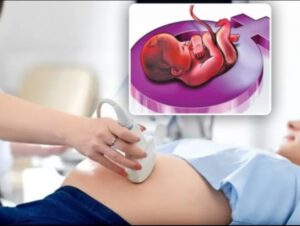 गर्भनिदान करणाऱ्या सोनोग्राफी सेंटरची माहिती द्या, आणि १ लाख रुपये मिळवा !